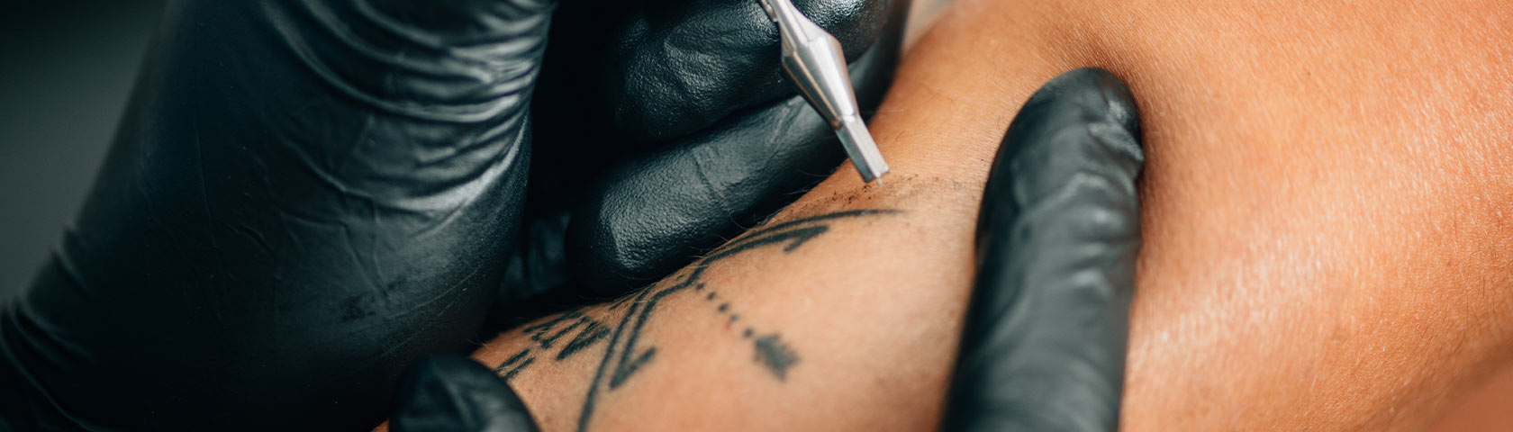 I'm going to change, why can't my body?': tattoo removal grows up | Tattoos  | The Guardian